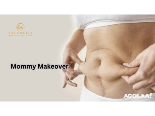 Best Mommy Makeover In Hyderabad