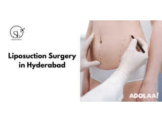 Liposuction surgery in Hyderabad - Dr. Sandhya Balasubramanyan