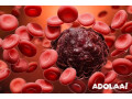 blood-cancer-treatment-in-india-cost-small-0