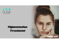 pigmentation-treatment-in-bangalore-small-0