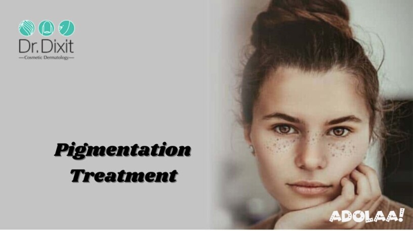 pigmentation-treatment-in-bangalore-big-0