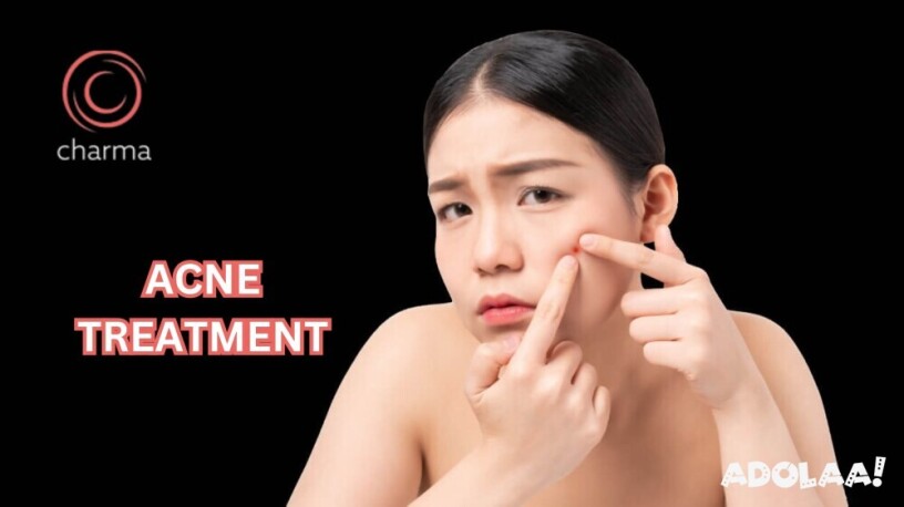 get-acne-treatment-in-bangalore-at-charma-clinic-big-0