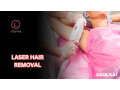 get-laser-hair-removal-in-bangalore-at-charma-clinic-small-0
