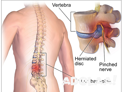 spine-surgery-cost-in-india-big-0