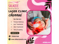 laser-clinic-chennai-silkeebeauty-small-0