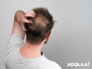 Transform Your Look with AK Clinics - Leading Hair Transplant in Gurgaon