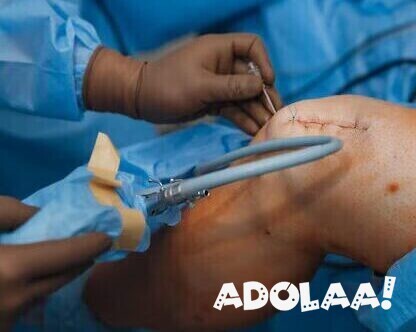 knee-replacement-surgery-cost-in-india-big-0