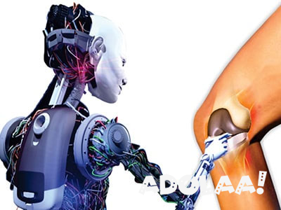 robotic-knee-replacement-surgery-big-0