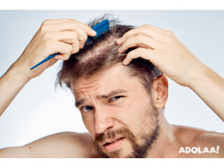 Affordable Hair Transplant Cost in Gurgaon