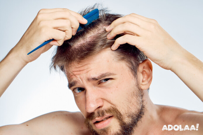 affordable-hair-transplant-cost-in-gurgaon-big-0