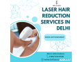 laser-hair-reduction-in-delhi-small-0