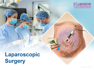 Low Cost Laparoscopic Surgery in Toli Chowki-lowcostivftreatment