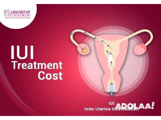 Cost of IUI Treatment in Hyderabad-lowcostivftreatment