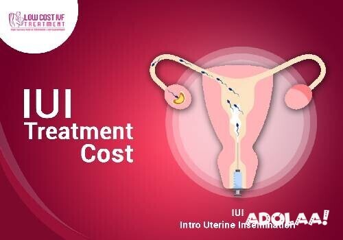 cost-of-iui-treatment-in-hyderabad-lowcostivftreatment-big-0