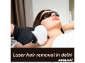 laser-hair-removal-in-delhi-small-0