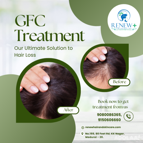gfc-treatment-renew-hair-and-skin-care-big-0
