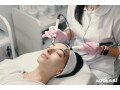 best-skin-clinic-in-bilaspur-in-2025-saluja-skin-clinic-small-0