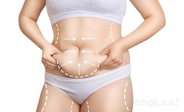 how-to-avoid-complications-for-liposuction-surgery-big-0