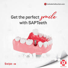 smile-makeover-big-0