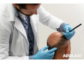 best-hair-transplant-clinic-in-bilaspur-saluja-skin-clinic-small-0