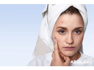 Best acne treatment Bilaspur 2025 | Saluja skin clinic