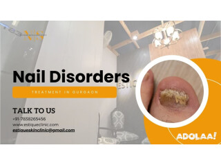 Nail Disorder Treatment In Gurgaon - Estique Skin & Hair Clinic