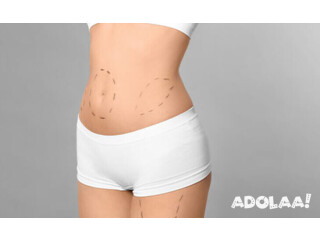 High-Definition Liposuction: Sculpt Your Body with Precision