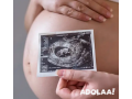 3d-4d-ultrasound-in-delhi-small-0