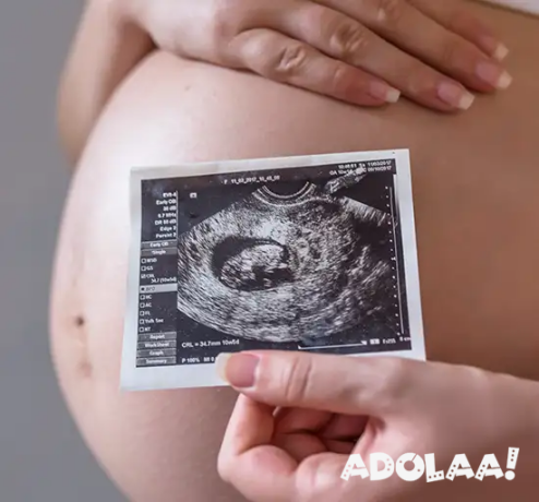 3d-4d-ultrasound-in-delhi-big-0