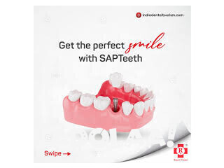 Same Day Dental Implant in India-IDT