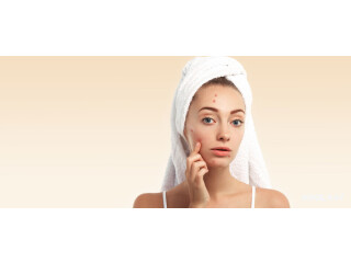 Skination Clinic - Effective Acne Treatment in Faridabad