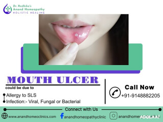 Discover Homeopathy Treatment for Mouth Ulcers!