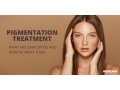 pigmentation-treatment-in-south-delhi-small-0