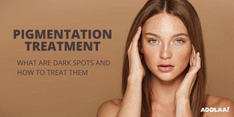 pigmentation-treatment-in-south-delhi-big-0