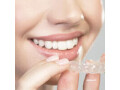 braces-treatment-in-delhi-invisible-braces-cost-in-delhi-invisalign-delhi-small-0
