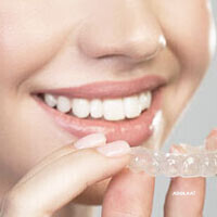 braces-treatment-in-delhi-invisible-braces-cost-in-delhi-invisalign-delhi-big-0