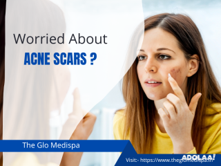 The Glo Medispa | Acne Scar Treatment in Ludhiana