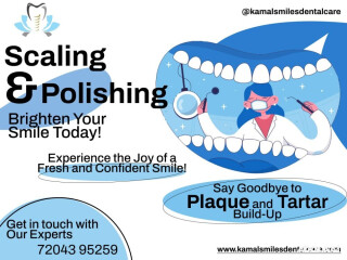 Brighten Your Smile with Our Scaling and Polishing Special!