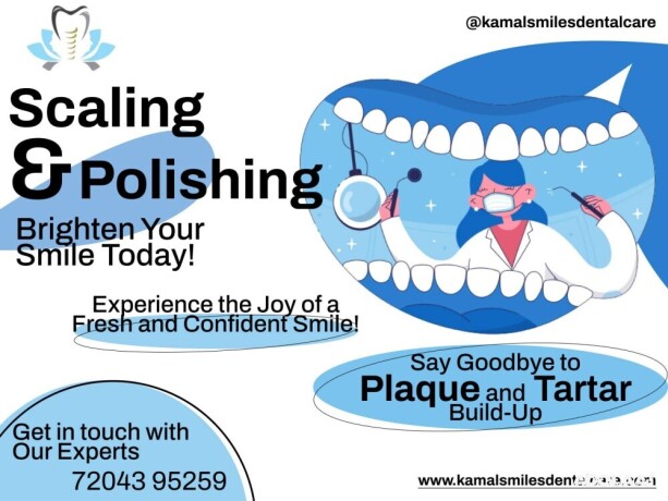brighten-your-smile-with-our-scaling-and-polishing-special-big-0