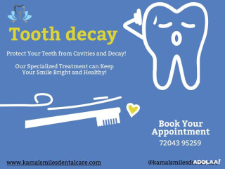 Revitalize Your Smile: Effective Tooth Decay Treatment at Kamal Smiles Dental Care!