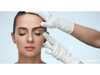 Blepharoplasty Surgery in Delhi