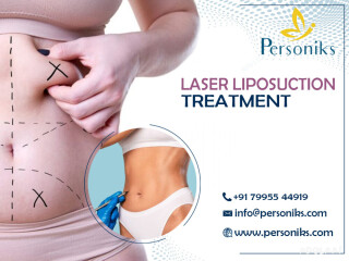 Liposuction Surgery in Hyderabad: Cost, Procedure, and Recovery