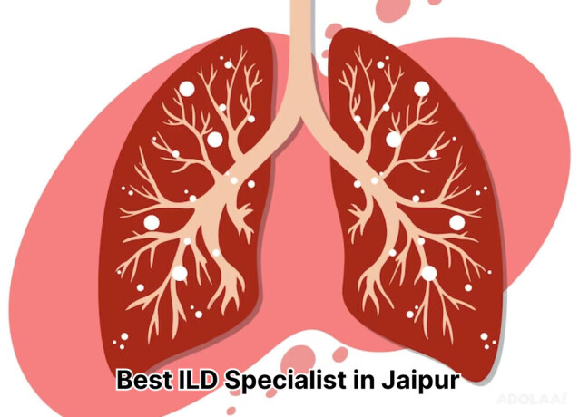 best-ild-specialist-in-jaipur-dr-sheetu-singh-big-0