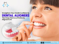get-a-picture-perfect-smile-with-dental-aligners-small-0