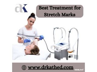 Smooth Skin Secrets: Best Treatment for Stretch Marks By Dr. Atul Kathed