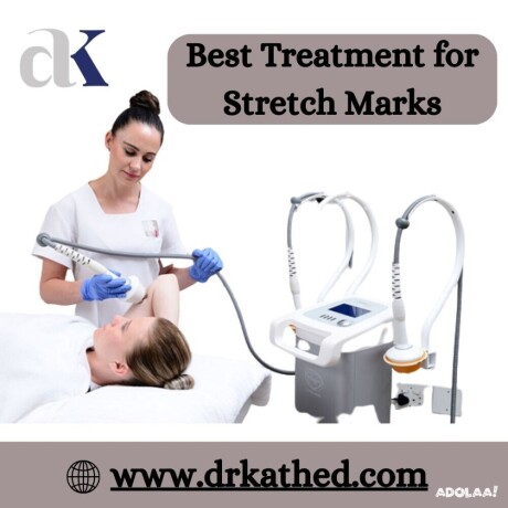 smooth-skin-secrets-best-treatment-for-stretch-marks-by-dr-atul-kathed-big-0