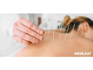 Relieve Pain with Expert Dry Needling Therapy in Denver