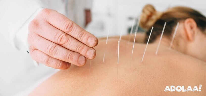 relieve-pain-with-expert-dry-needling-therapy-in-denver-big-0