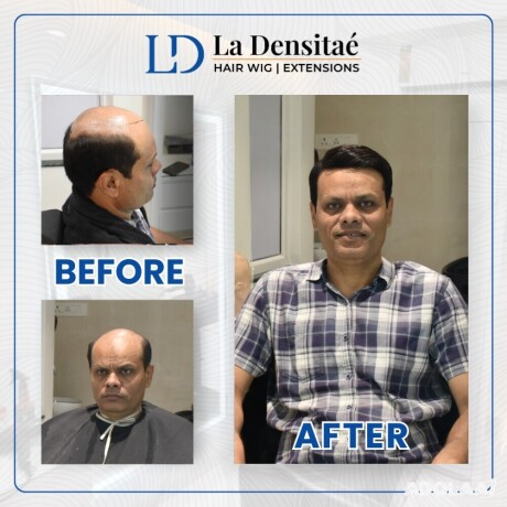 hair-patch-in-pune-restoring-confidence-with-la-densitae-hair-wig-big-1