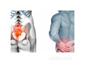 treatment-for-sacroiliac-joint-pain-small-0